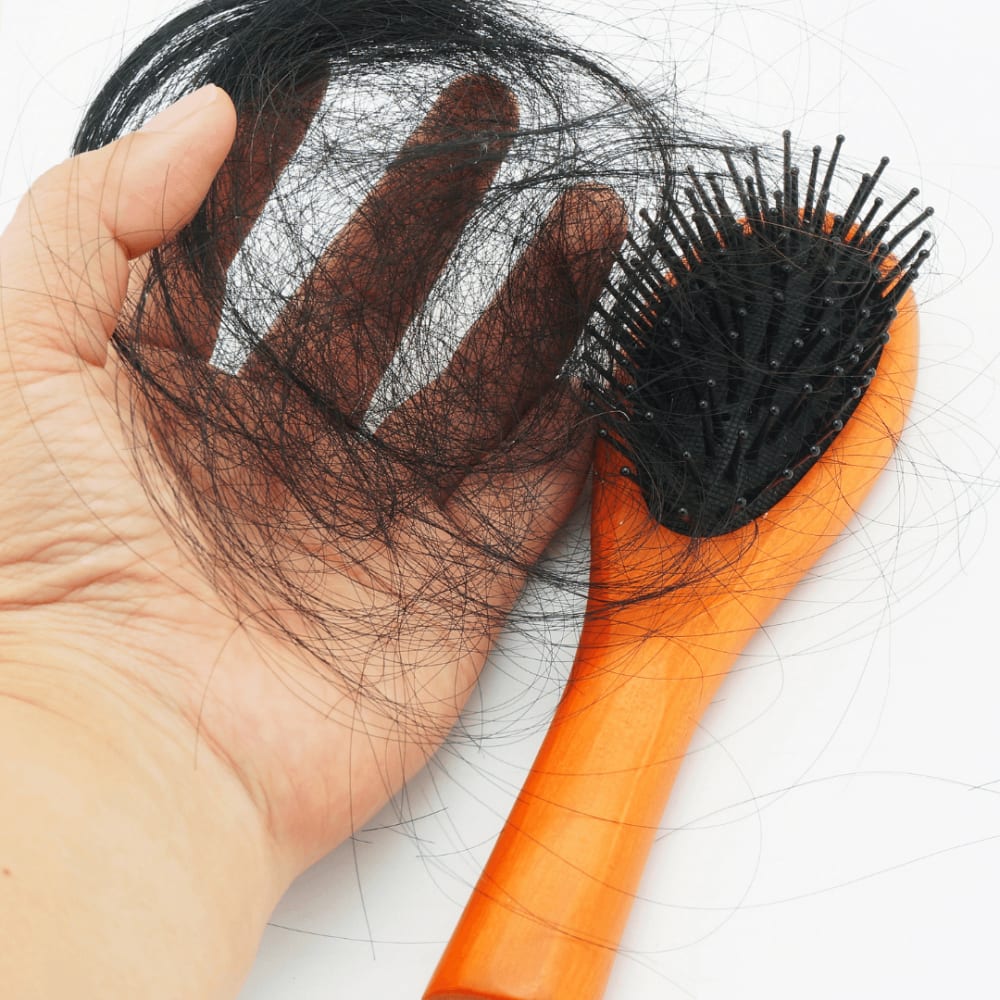 How To Treat Pcos Hair Loss How To Treat Pcos Hair Loss